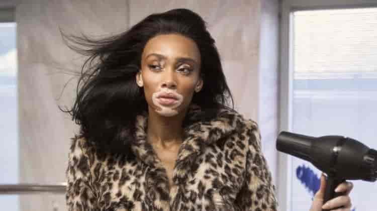 Winnie Harlow Wears Animal Prints in Harper’s Bazaar Taiwan